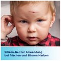 BEPANCARE Narben-Gel